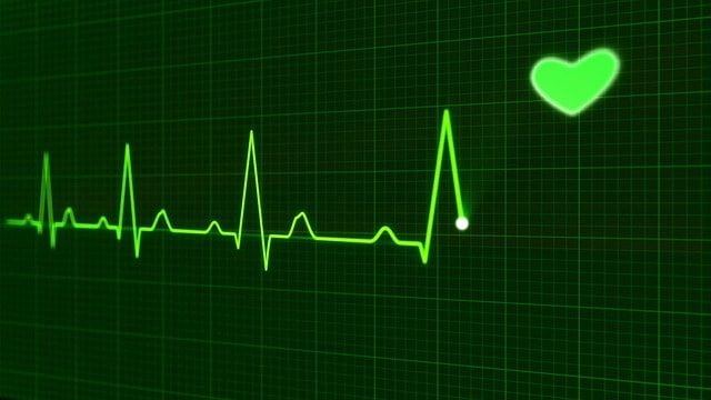 Apple Watch électrocardiogramme