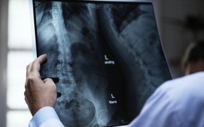 Radiographie santé