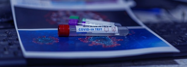 Tests de dépistage Covid-19